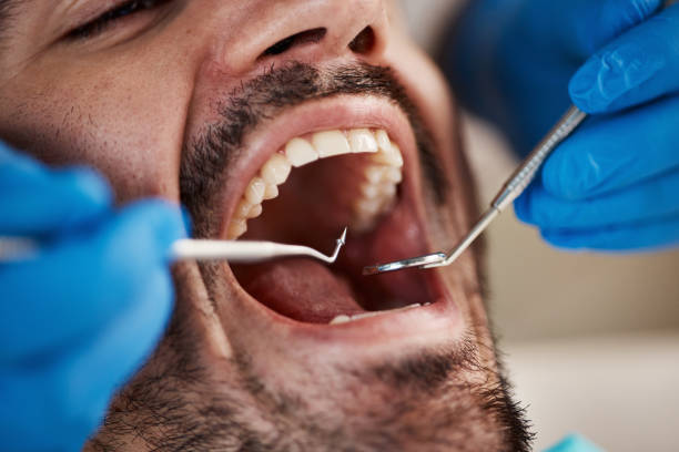 Best Preventive Dentistry  in Baldwinville, MA